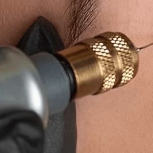 Advanced Techniques in Laser Blepharoplasty